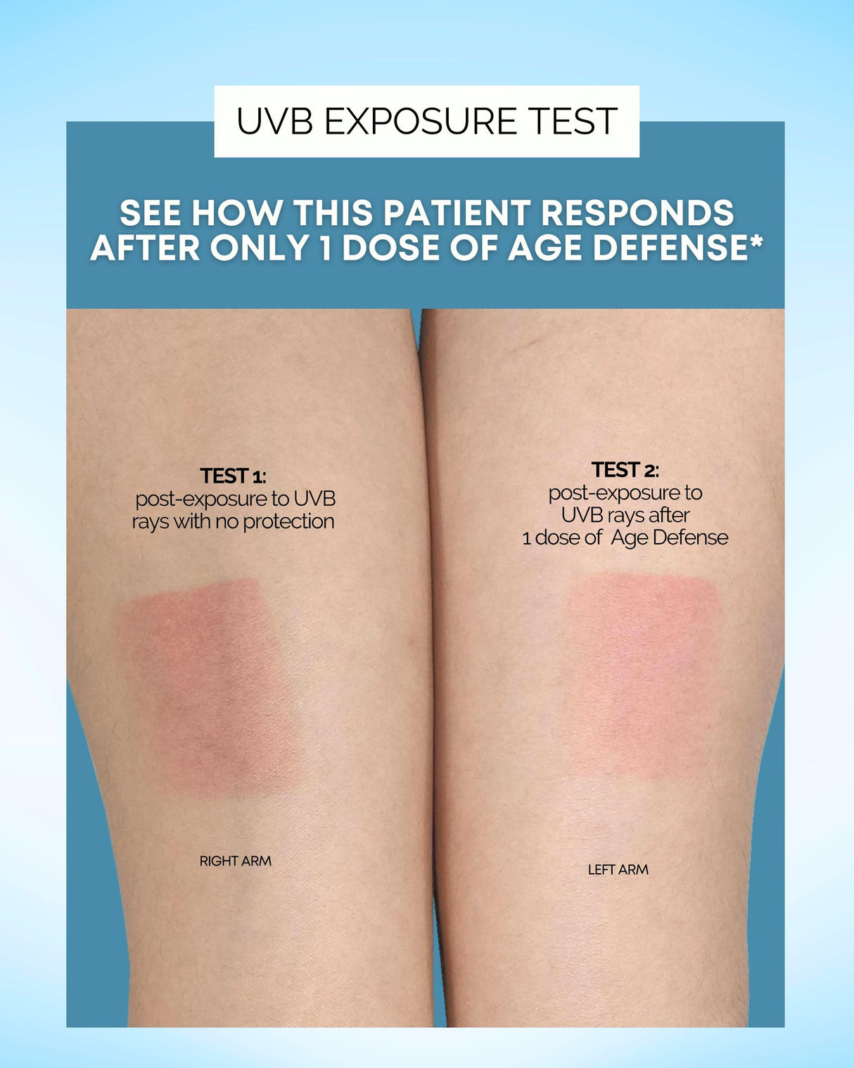 Inner Glow Age Defense Vitamins - Dermatologist and Plastic Surgeon Developed to Fight photoaging and Melasma, Polypodium Leucotomos Antioxidant Formula – Vegan, Gluten-Free – 60 Capsules