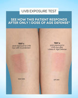 Inner Glow Age Defense Vitamins - Dermatologist and Plastic Surgeon Developed to Fight photoaging and Melasma, Polypodium Leucotomos Antioxidant Formula – Vegan, Gluten-Free – 60 Capsules