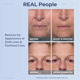 Plexaderm Rapid Reduction Eye Serum - Visibly Reduces Under-Eye Bags, Wrinkles, Dark Circles, Fine Lines & Crow's Feet Instantly, Anti Aging Wrinkle Remover for Face, Full Size Tube