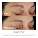 Epionce Intense Defense Serum - Anti-Aging Facial Serum with Vitamin C, Vitamin E, Vitamin D, A, B, & Niacinamide, Dermatologist Skincare