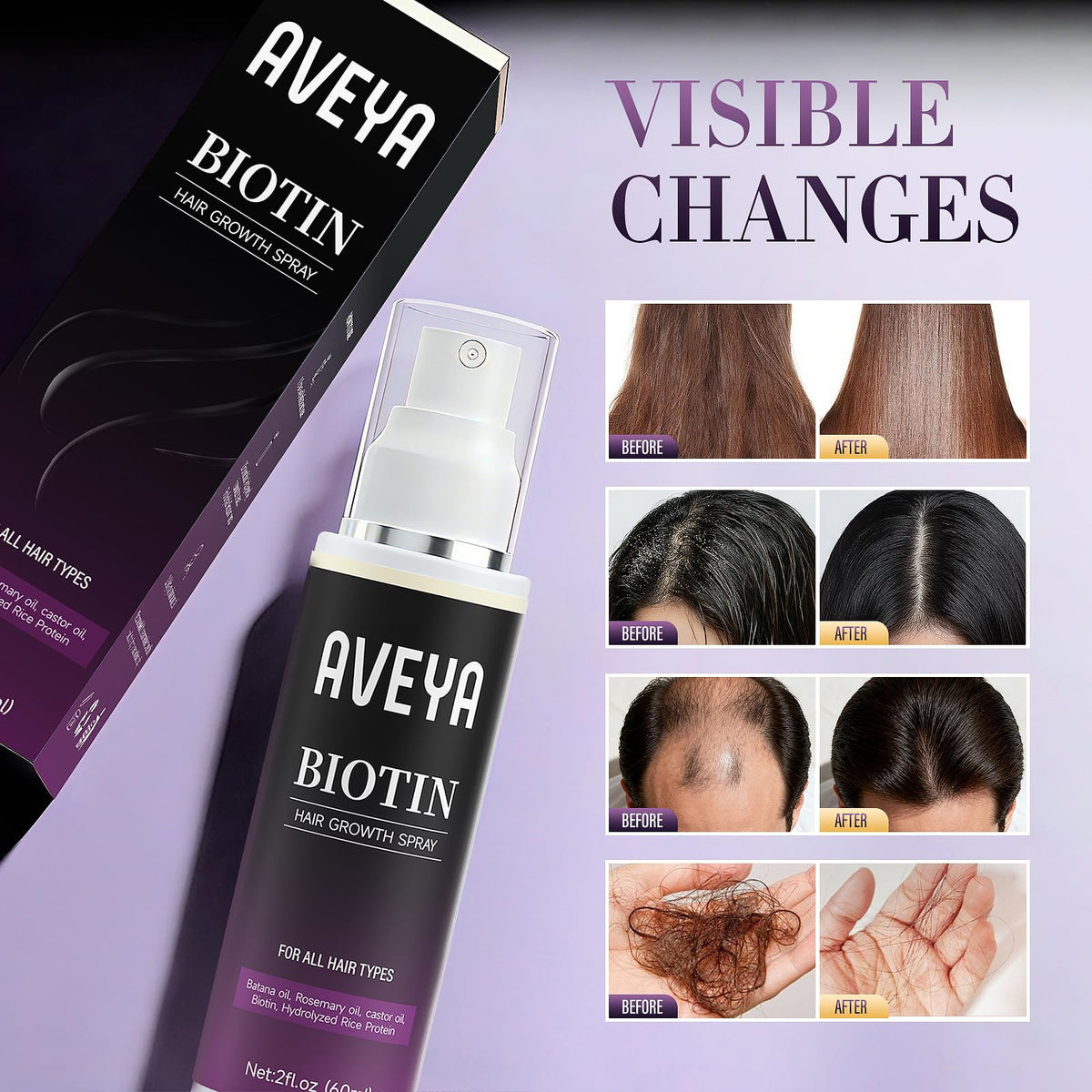 AVEYA Hair Growth Spray, infused with Rosemary Oil,rice water,Batana Oil&Biotin for Scalp – Strengthens,Thickens&Accelerates Hair Care - Non-Greasy,Helps Prevent Hair Thinning & Hair Loss – 60ml