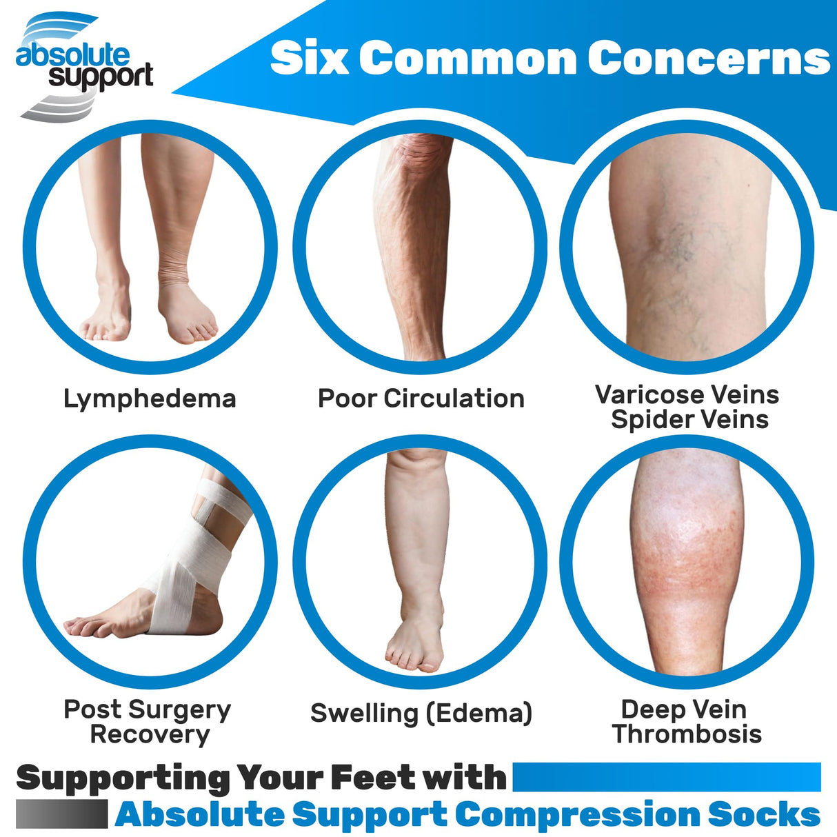 Made in USA - Wide Calves Womens Compression Stockings for Circulation 15-20mmHg - Toeless Compression Knee High Support Socks for Travel, Nursing, Sports, Athletic - Nude, 2X-Large - A111NU5
