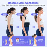 Kepwaa Posture Corrector for Women and Men, Upgraded Full Back Brace Support, Adjustable Shoulder Straightener for Improving Back Posture, Relief for Upper and Lower Back, Lumbar, Neck, Shoulder Pain