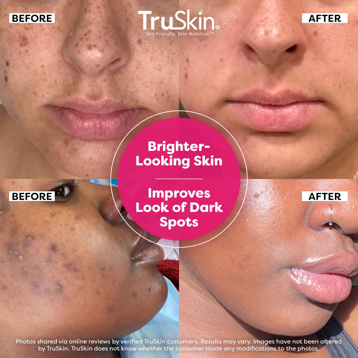 TruSkin Vitamin C Super Serum - Niacinamide, Retinol, Hyaluronic & Salicylic Acid - All-in-One Anti Aging Serum for Face – Improve Appearance of Dark Spots, Firmness for Brighter Looking Skin, 1 Fl Oz