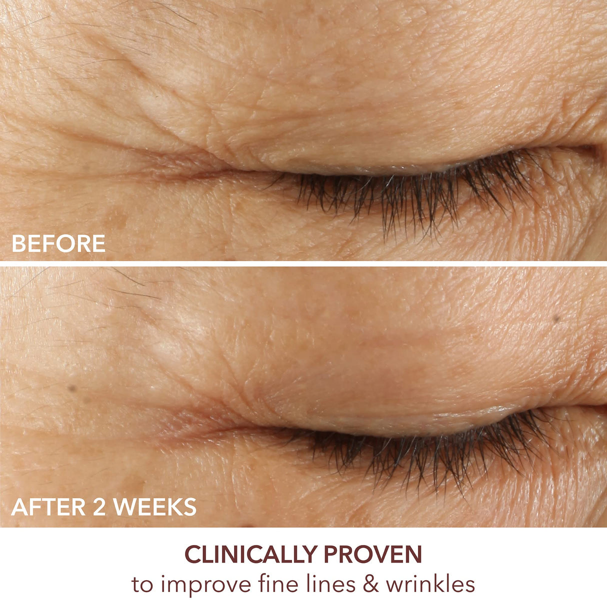 Dr. Dennis Gross Advanced Retinol + Ferulic Eye Serum – Target Dark Circles, Puffiness, Fine Lines & Wrinkles for Smooth, Youthful-Looking Eyes, 0.5 oz