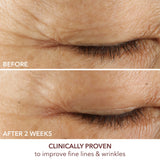 Dr. Dennis Gross Advanced Retinol + Ferulic Eye Serum – Target Dark Circles, Puffiness, Fine Lines & Wrinkles for Smooth, Youthful-Looking Eyes, 0.5 oz