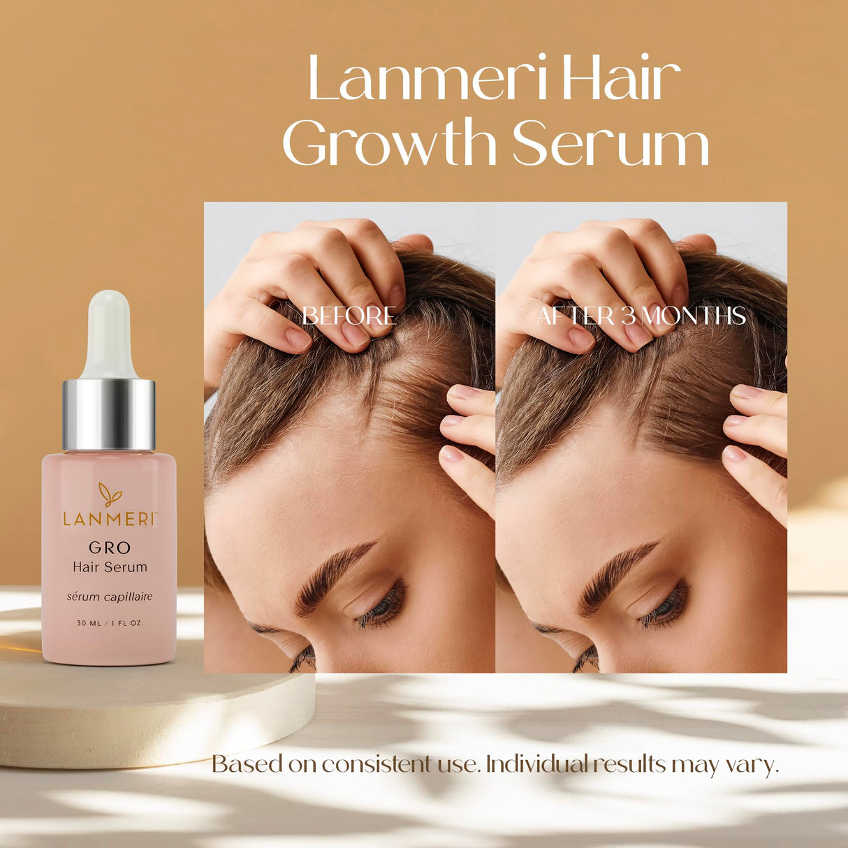 Lanmeri Vegan Hair Growth Serum for Women & Men - Natural Scalp Treatment for Thinning Hair and Hair Regrowth - Fuller-looking, Thicker and Healthier Hair in 90 Days, All Hair Types