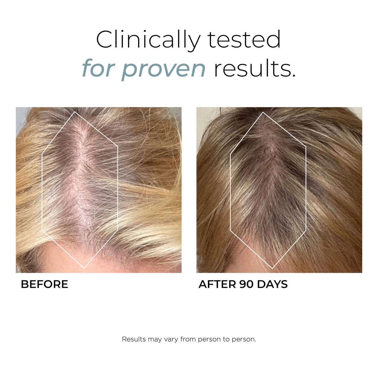 Hush & Hush DeeplyRooted Hair Supplement for Stronger, Healthier Hair - Collagen Hair Growth Pills for Men & Women - Biotin for Hair Loss - Hair Care for Thinning Hair & Hair Regrowth - 120 Capsules