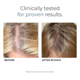 Hush & Hush DeeplyRooted Hair Supplement for Stronger, Healthier Hair - Collagen Hair Growth Pills for Men & Women - Biotin for Hair Loss - Hair Care for Thinning Hair & Hair Regrowth - 120 Capsules