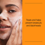 Neutrogena Oil Free Acne Face Wash, 9.1 fl. oz, 3 Pack