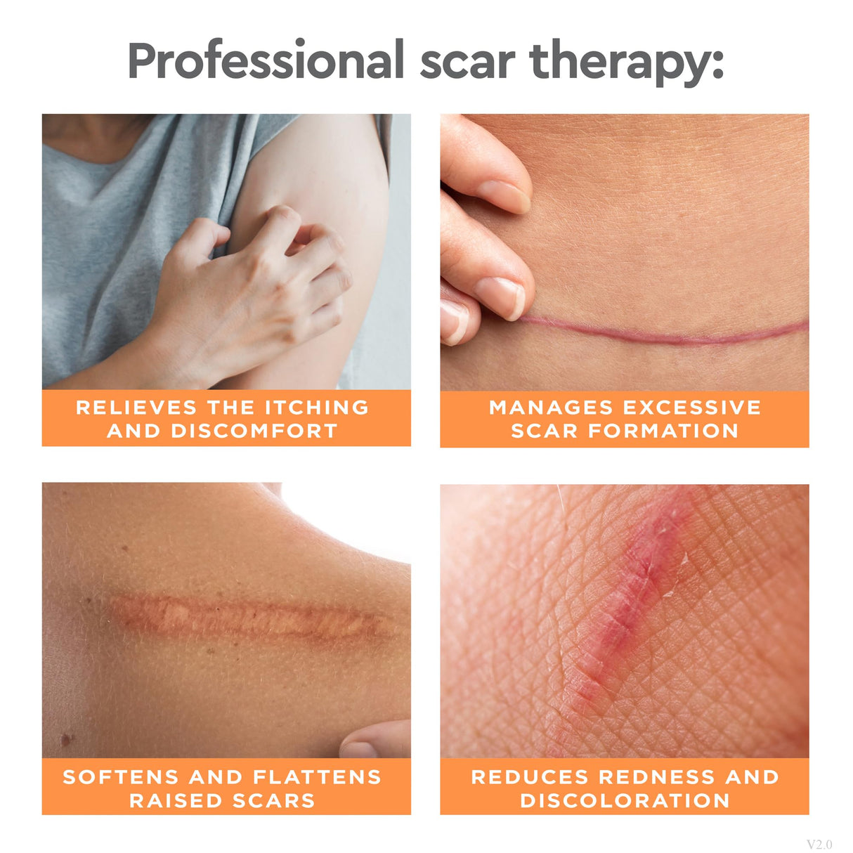 Strataderm Professional Scar Therapy Gel | Old and New Scars from General Surgery, Trauma, Wounds, Burns, Bites, Acne & Skin Disease | Reduces Redness, Discoloration, Discomfort & Itch | 10g (0.35oz)