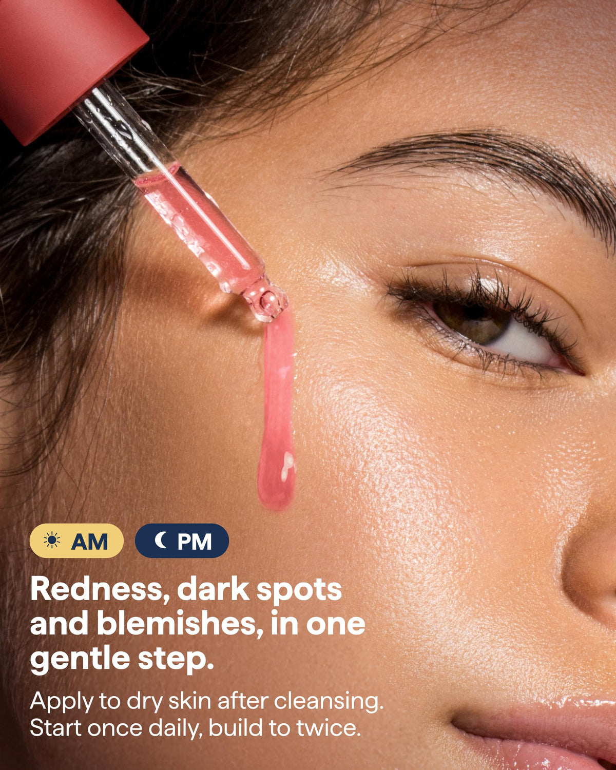 REMEDY 15% Azelaic Acid Complex Advanced Clarifying Serum