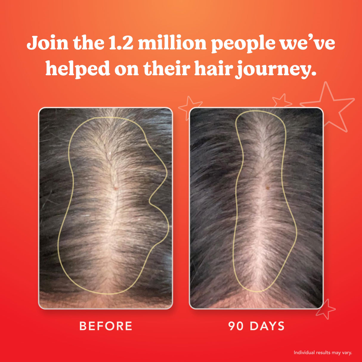 HAIRtamin Advanced Formula Hair Vitamins for Women & Men | Vegan 5000 Mcg Biotin Capsules Vitamin Supplement | Hair Skin and Nail Capsule Supplement to Promote Hair Growth & Thickness | 30 Count