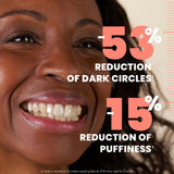 Avène RetrinAL EYES, Retinaldehyde & Hyaluronic Acid MO, Reduce the Appearance of Fine Lines, Puffiness, Dark Circles, 0.5 Oz