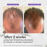 Dr. Groot Miracle in Shower Treatment for Hair Loss, Korean Hair Care, 5 Seconds to Smooth Hair, Rosemary Oil for Healthier-Looking Hair, Hair Rinse, Moisturizing Treatment,Scalp Revitalizing Solution