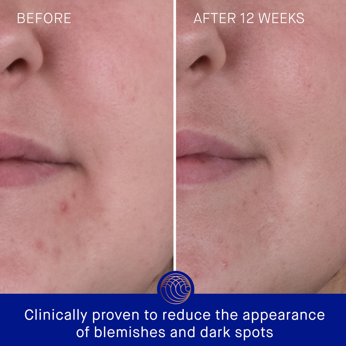 Augustinus Bader The Rich Cream 30ml