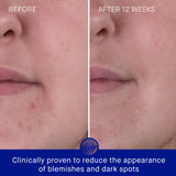 Augustinus Bader The Rich Cream 30ml