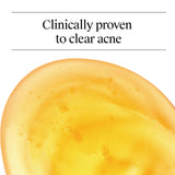 Neutrogena Oil Free Acne Face Wash, 9.1 fl. oz, 3 Pack