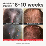 iRESTORE Advanced Hair Growth Supplement for Women with Lustriva | Hair Vitamins For Faster Hair Regrowth | Best for Hair Loss and Thinning, 1 Month Supply