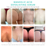 Almond Clear Level 2 Serum | Mandelic Acid Body Serum for Acne, Folliculitis, Aging Skin, Ingrown Hairs, Dark Spots on Face, Chest, Butt, Back, Thighs, Arms | 4 oz