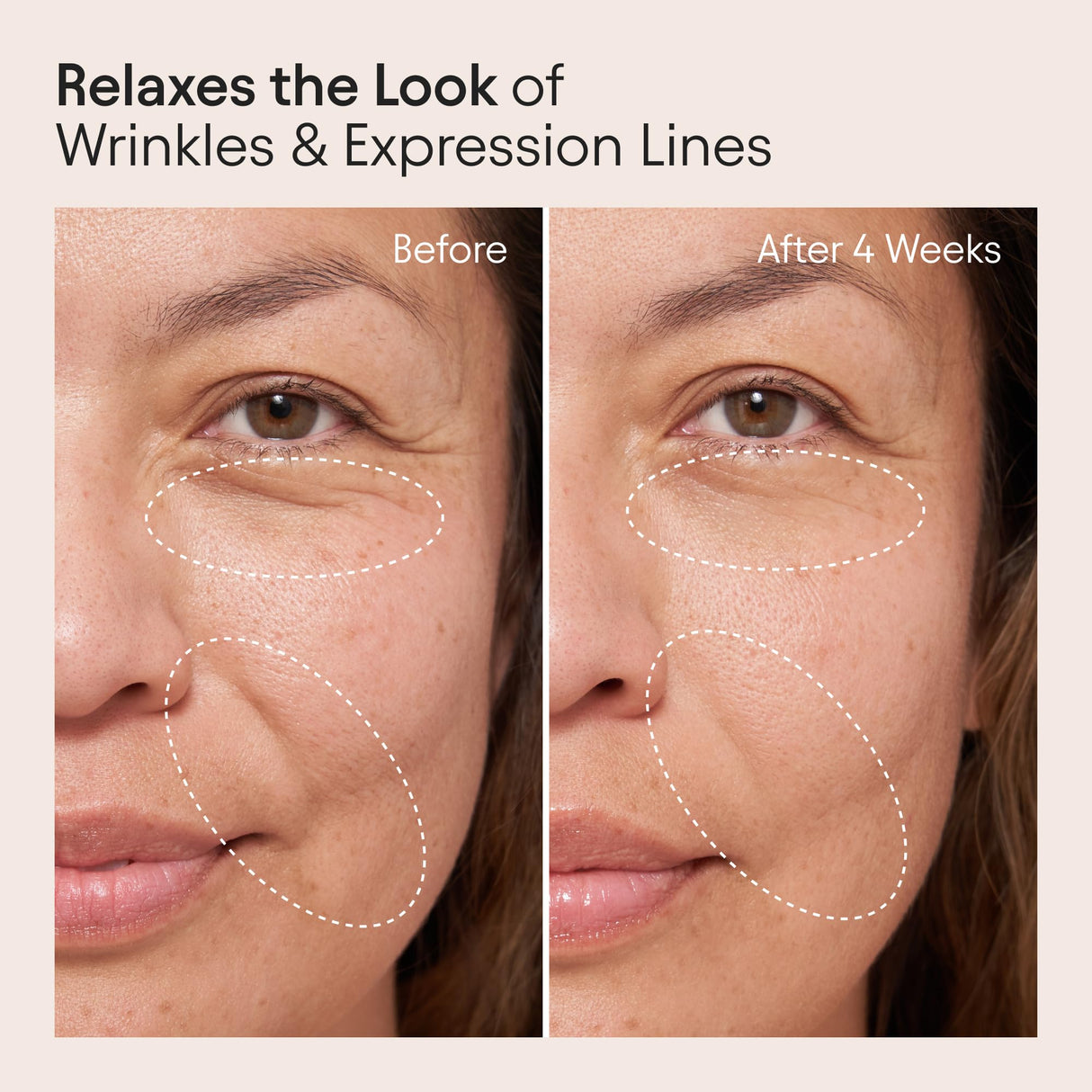 Alpyn Super Peptide & Ghostberry Moisturizer for Eczema, Barrier & Wrinkle Repair | Calm & Soothe Against Redness & Irritation | 1.7 oz / 50 ml