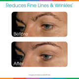 Sparkle Skin Boost (Mixed Berry) [30-Serves] Verisol Collagen Peptides Protein Powder Vitamin C Supplement Drink