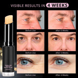VELAMO ADVANCED Retinol Eye Stick: Retinol Eye Cream for Dark Circles and Puffiness with 1% Bakuchiol and Caffeine - Visibly Reduces Fine Lines Wrinkles Under Eye Bags with Upgraded Formula 0.1 OZ/3g