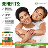 Perfect Skin Acne Capsules – Niacinamide, Biotin, Vitamin A & Probiotics for Teens & Adults – 13 Powerful Ingredients for Face Acne, Acne Scars & Dark Spots – 60 Vegan Capsules, Made in the USA