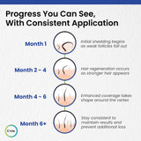 C’rcle Men's Minoxidil 5% Foam - 6 Month Supply - Helps Restore Vertex Hair Loss & Thinning Hair - Extra Strength Supports Hair Regrowth for Men, Unscented Hair Loss Treatments for Men