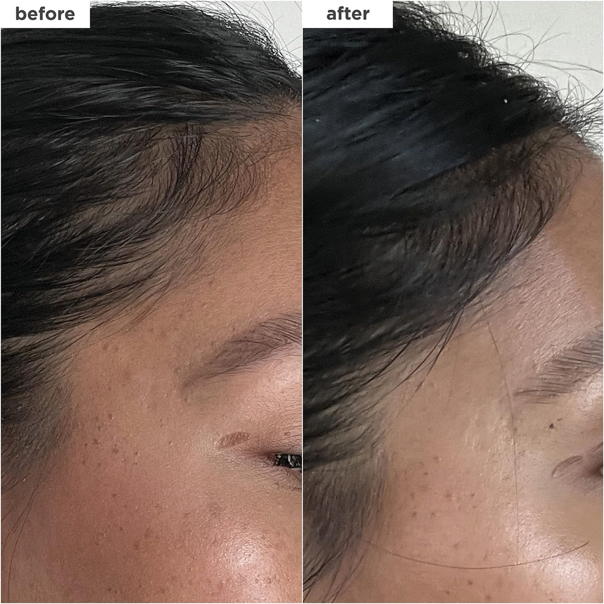 Briogeo Destined For Density MegaStrength+ Caffeine + Biotin Peptide Density Serum, Increases Hair Thickness and Density, Fast-Absorbing & Non-Greasy, Fragrance-Free, Vegan, Cruelty-Free, 1.5 fl oz