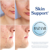 DIM Supplement 200 mg | Estrogen Balance for Women & Men | Hormonal Acne, Hormone Balance, Menopause & Antioxidant Support | Clean Label Project Certified, Vegan & Soy Free Diindolylmethane | 60 Ct.