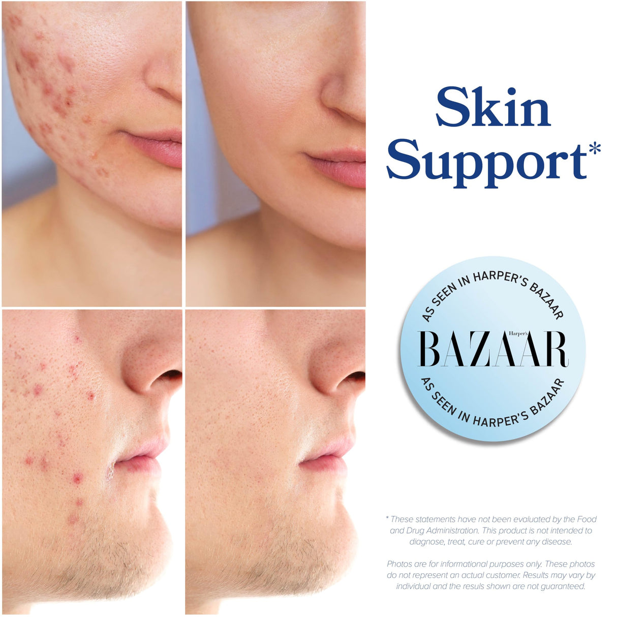 DIM Supplement 200 mg (120 Ct) | Estrogen Balance for Women & Men | Hormone Balance, Hormonal Acne Supplements, Menopause, Antioxidant & PMS Support | Non-GMO, Vegan, Soy Free | 4 Month Supply