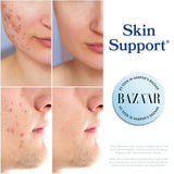 DIM Supplement 200 mg (120 Ct) | Estrogen Balance for Women & Men | Hormone Balance, Hormonal Acne Supplements, Menopause, Antioxidant & PMS Support | Non-GMO, Vegan, Soy Free | 4 Month Supply