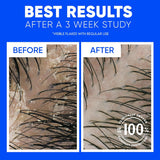 Head & Shoulders Classic Clean Anti-Dandruff Shampoo Twin Pack, 32.1 fl oz Each, 72-Hour Dandruff Protection, Safe for Everyday Use on All Hair Types
