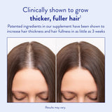 Routine Wellness Hair Growth Supplement - Clinically Proven for Thicker, Fuller Hair - Reduces Wrinkles, Fine Lines - Gluten Free, Ideal for Women & Men with Thinning Hair - 3 Bottles, 90 Day Supply