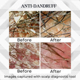 ABERA Amanda Anti-Dandruff Shampoo for Stronger Hair & Healthier Scalp, Nourishes, Get Rid of Dandruff