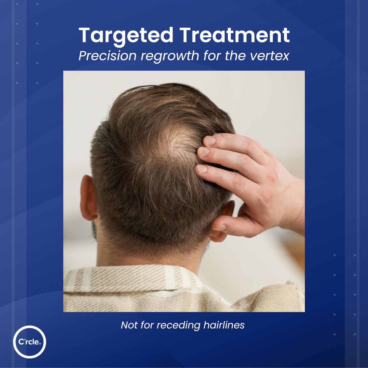 C’rcle Men's Minoxidil 5% Foam - 6 Month Supply - Helps Restore Vertex Hair Loss & Thinning Hair - Extra Strength Supports Hair Regrowth for Men, Unscented Hair Loss Treatments for Men