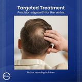 C’rcle Men's Minoxidil 5% Foam - 6 Month Supply - Helps Restore Vertex Hair Loss & Thinning Hair - Extra Strength Supports Hair Regrowth for Men, Unscented Hair Loss Treatments for Men