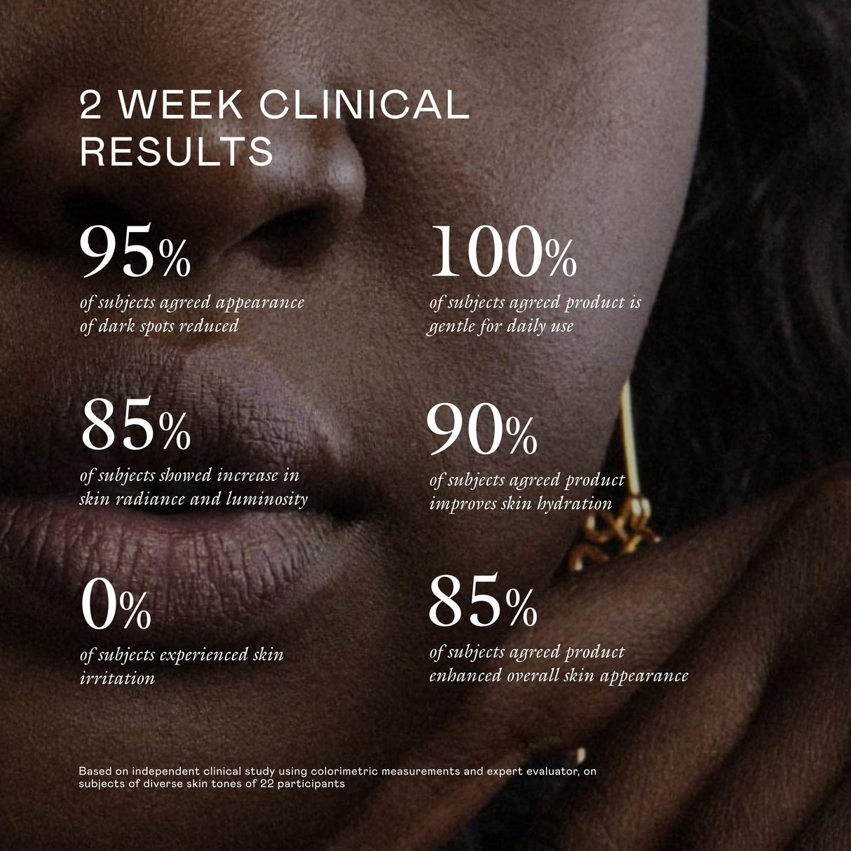 EADEM Milk Marvel Dark Spot Serum, Vitamin C Face Serum Infused with Niacinamide, Dark Spot Remover for Face & Body, Dark Spot Corrector for Skin Care, 1 oz