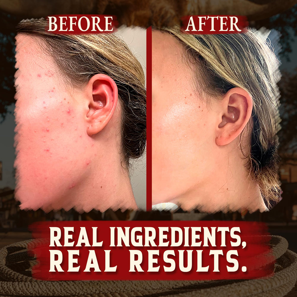 Wrath & Remedy Handmade Whipped Organic Beef Tallow for Skin - 4 OZ (Unscented) — Grass Fed Beef Tallow Moisturizer and Honey Balm for Silky, Sensitive-Skin, Eczema, Rosacea - Free of Harsh Chemicals