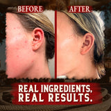 Wrath & Remedy Handmade Whipped Organic Beef Tallow for Skin - 4 OZ (Unscented) — Grass Fed Beef Tallow Moisturizer and Honey Balm for Silky, Sensitive-Skin, Eczema, Rosacea - Free of Harsh Chemicals