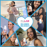 ProLab Organics InstaBum Bum Enhancement Pills – Lift, Shape, and Fill Glutes – Fast Growth for Bigger Butt and HIPS – No Gummies. Visible Results in 1-2 Weeks