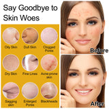 Skin Care Set,Women Teen Glass Skincare w/Korean Rice Extract,Hydrate Glow Repair Anti-Aging Facial Routine Kit Gift Set for Women Mom Wife Teenager Girl Trendy Stuff Christmas Gifts Stocking Stuffers