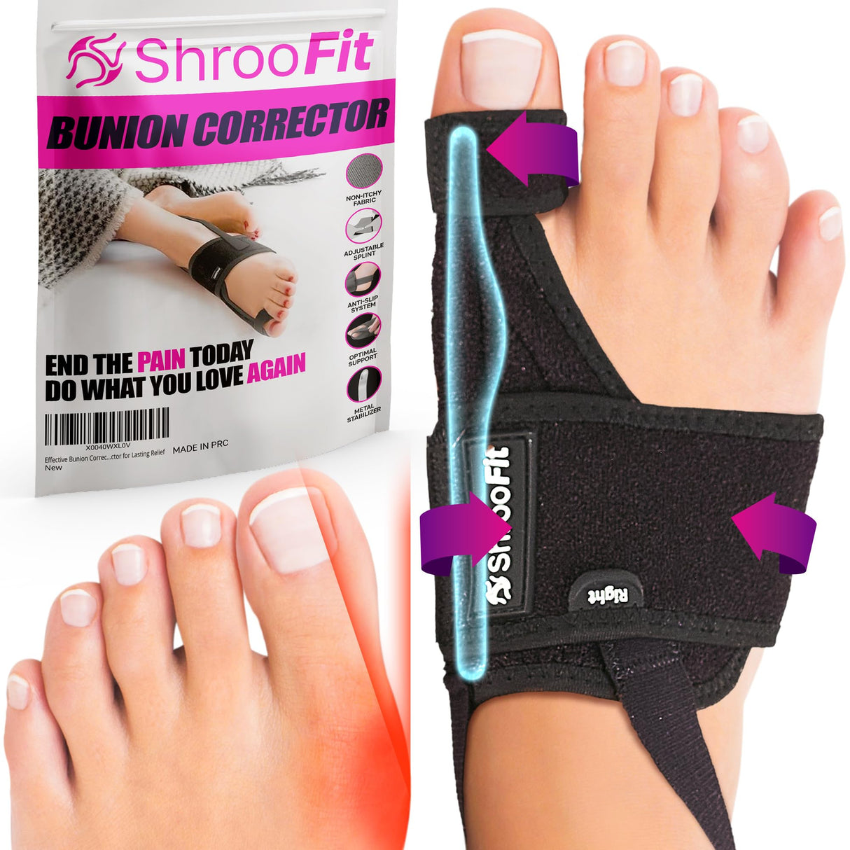 ShrooFit Effective Bunion Corrector for Men & Women | Relief Kit with Cushion Sleeves | Toe Straightener – Large/X-Large