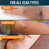 NUVADERMIS Silicone Scar Tape for Kids - Scar Tape for Surgical Scars - 120" x 1.5" Roll - Reusable Medical Grade Silicone Scar Tape for Children - 1 Pack - Dinosaurs