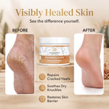 Vitality Extracts Frankincense Essential Oil Balm (2oz) – Boswellia Serrata, Beeswax & Vitamin E, Deep Moisturizing Skin Balm for Dry, Cracked Skin, Soothing & Nourishing for All Skin Types