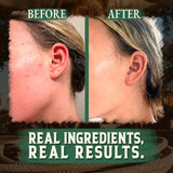Wrath & Remedy Handmade Whipped Organic Beef Tallow for Skin - 4 OZ (Eucalyptus) — Grass Fed Beef Tallow Moisturizer and Honey Balm for Silky, Sensitive-Skin, Eczema, Rosacea - Free of Harsh Chemicals