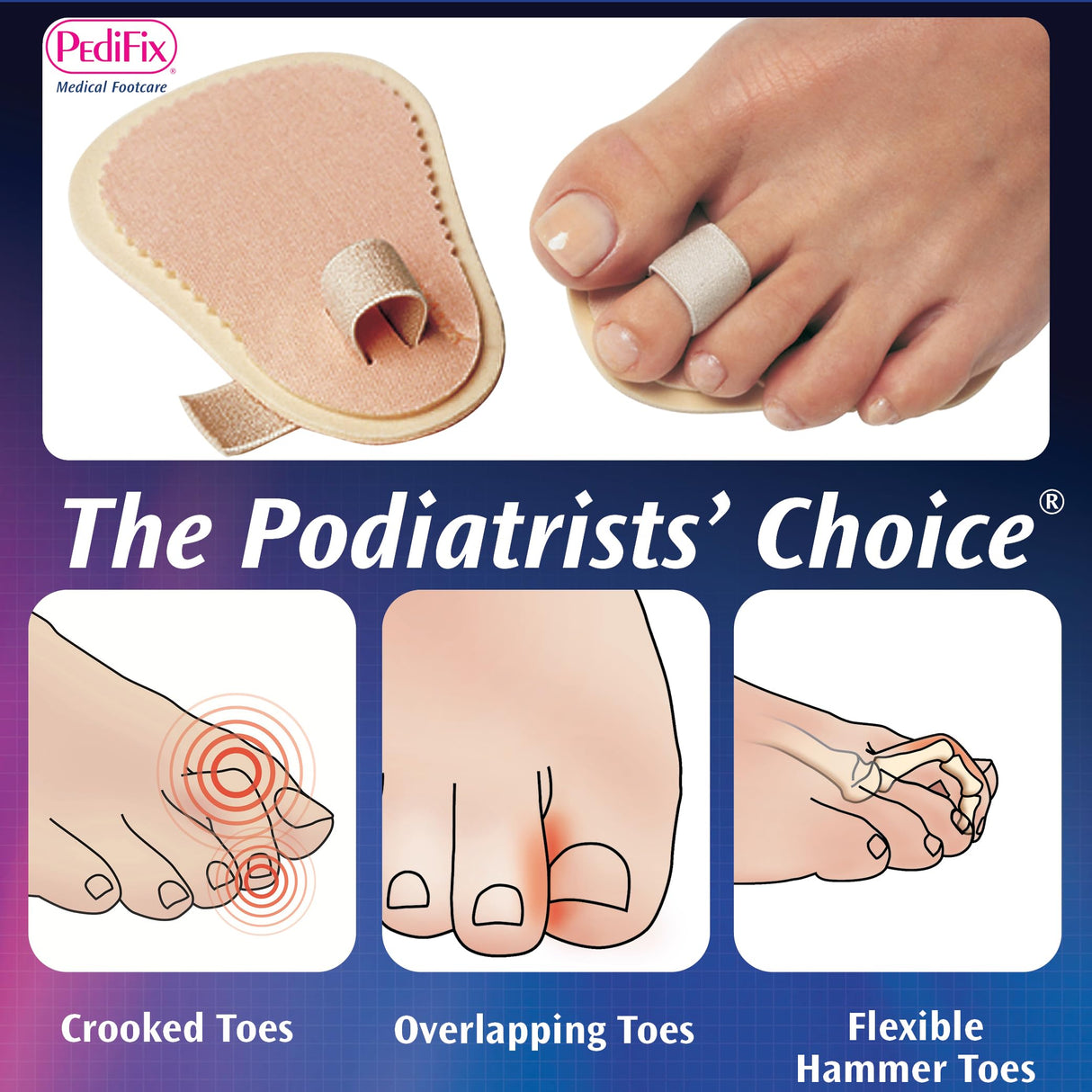 PediFix Podiatrists' Choice Toe Straightener – 3-Pack Toe Aligners Gently Help Realign Crooked, Overlapping, and Hammer Toes – Designed for Comfort and Daily Relief – One Size Fits Most