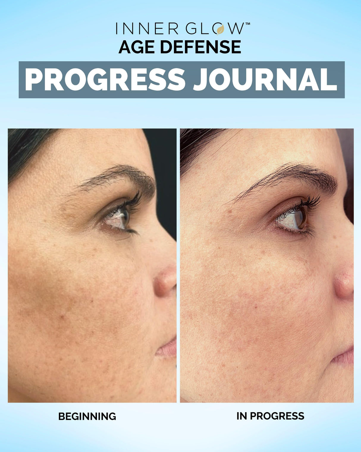 Inner Glow Age Defense Vitamins - Dermatologist and Plastic Surgeon Developed to Fight photoaging and Melasma, Polypodium Leucotomos Antioxidant Formula – Vegan, Gluten-Free – 60 Capsules