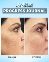 Inner Glow Age Defense Vitamins - Dermatologist and Plastic Surgeon Developed to Fight photoaging and Melasma, Polypodium Leucotomos Antioxidant Formula – Vegan, Gluten-Free – 60 Capsules